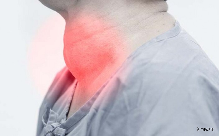 Boynunuzda Şişlik Varsa Dikkat