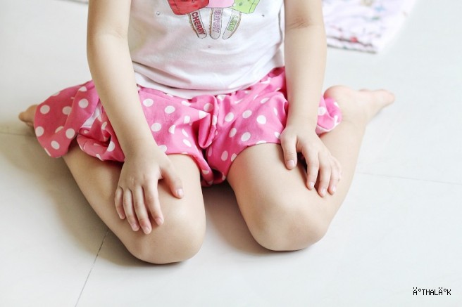 Yaz Aylarında Pişik Sorununa Dikkat! 